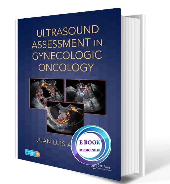 دانلود کتابUltrasound Assessment in Gynecologic Oncology 2018(ORIGINAL PDF)  